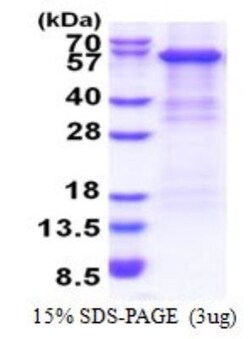 Novus Biologicals&trade;&nbsp;Recombinant Human Complement Factor B His Protein