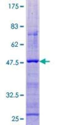 Novus Biologicals Recombinant Human Cortistatin GST (N-Term) Protein 2 &mu;g | Buy Online | Novus Biologicals&trade; | Fisher Scientific