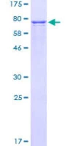Novus Biologicals Recombinant Human Craniofacial Development Protein 1 GST (N-Term) Protein 10 &mu;g | Buy Online | Novus Biologicals&trade; | Fisher Scientific