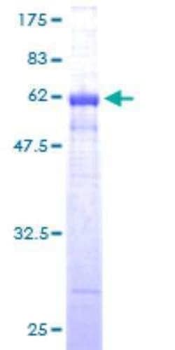 Novus Biologicals Recombinant Human Cyclin D1 GST (N-Term) Protein 10 &mu;g | Buy Online | Novus Biologicals&trade; | Fisher Scientific