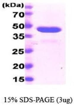 Novus Biologicals Recombinant Human Cyclophilin 40 His Protein 0.1 mg | Buy Online | Novus Biologicals&trade; | Fisher Scientific