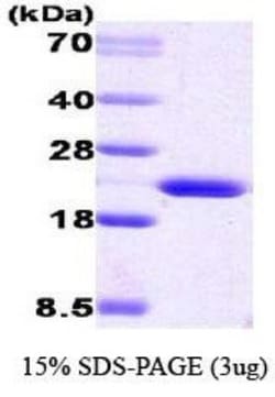 Novus Biologicals&trade;&nbsp;Recombinant Human Cyclophilin B Protein
