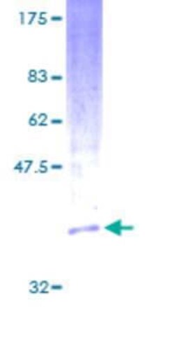 Novus Biologicals Recombinant Human Cyclophilin C GST (N-Term) Protein 10 &mu;g | Buy Online | Novus Biologicals&trade; | Fisher Scientific