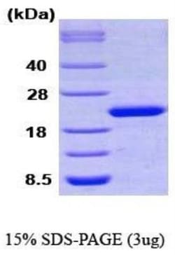 Novus Biologicals&trade;&nbsp;Recombinant Human Cyclophilin-F His Protein
