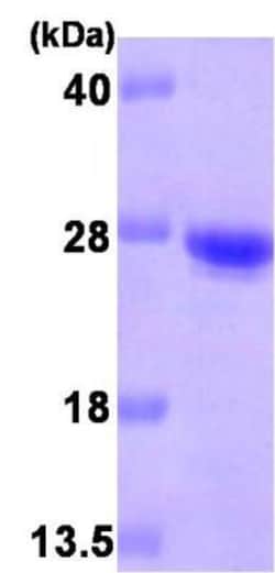 Novus Biologicals&trade;&nbsp;Recombinant Human Cysteine Dioxygenase Type 1 His Protein