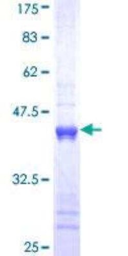Novus Biologicals Recombinant Human Cytokeratin 1 GST (N-Term) Protein 10 &mu;g | Buy Online | Novus Biologicals&trade; | Fisher Scientific