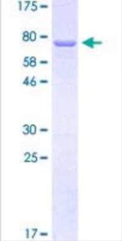 Novus Biologicals™ Recombinant Human Cytokeratin 12 GST (N-Term) Protein