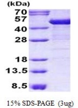 Novus Biologicals&trade;&nbsp;Recombinant Human Cytokeratin 19 His Protein