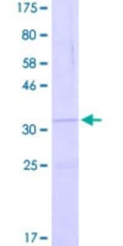 Novus Biologicals Recombinant Human DEFB109P1B GST (N-Term) Protein 25 &mu;g | Buy Online | Novus Biologicals&trade; | Fisher Scientific