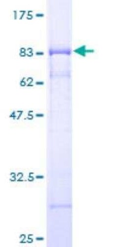 Novus Biologicals Recombinant Human DEPTOR/DEPDC6 GST (N-Term) Protein 25 &mu;g | Buy Online | Novus Biologicals&trade; | Fisher Scientific