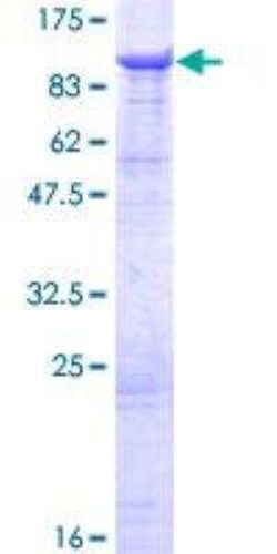 Novus Biologicals Recombinant Human DHX58 GST (N-Term) Protein 25 &mu;g | Buy Online | Novus Biologicals&trade; | Fisher Scientific