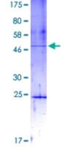 Novus Biologicals Recombinant Human DIP2A GST (N-Term) Protein 10 &mu;g | Buy Online | Novus Biologicals&trade; | Fisher Scientific