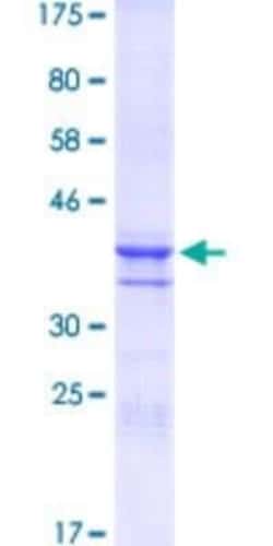 Novus Biologicals Recombinant Human DLX2 GST (N-Term) Protein 25 &mu;g | Buy Online | Novus Biologicals&trade; | Fisher Scientific