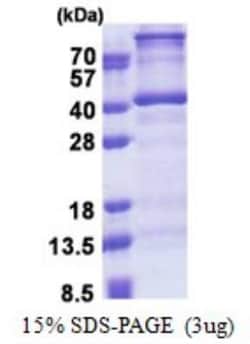 Novus Biologicals&trade;&nbsp;Recombinant Human DNTTIP1 His Protein