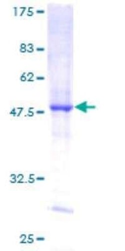 Novus Biologicals Recombinant Human DUSP14 GST (N-Term) Protein 25 &mu;g | Buy Online | Novus Biologicals&trade; | Fisher Scientific