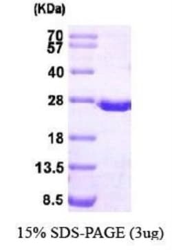 Novus Biologicals Recombinant Human Dihydrofolate Reductase/DHFR His Protein