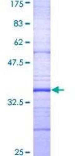 Novus Biologicals Recombinant Human Dopamine D2R/DRD2 GST (N-Term) Protein 25 &mu;g | Buy Online | Novus Biologicals&trade; | Fisher Scientific
