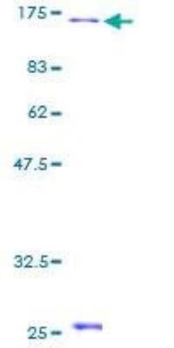 Novus Biologicals Recombinant Human Drebrin 1 GST (N-Term) Protein 25 &mu;g | Buy Online | Novus Biologicals&trade; | Fisher Scientific