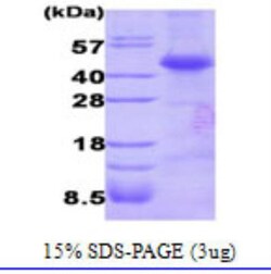 Novus Biologicals Recombinant Human Dysbindin His Protein 0.1mg; Unlabeled | Buy Online | Novus Biologicals&trade; | Fisher Scientific