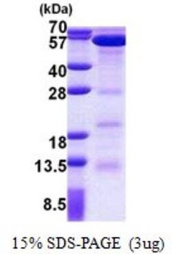 Novus Biologicals&trade;&nbsp;Recombinant Human EED His Protein