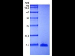 Novus Biologicals Recombinant Human EGF Protein 500 &mu;g | Buy Online | Novus Biologicals&trade; | Fisher Scientific