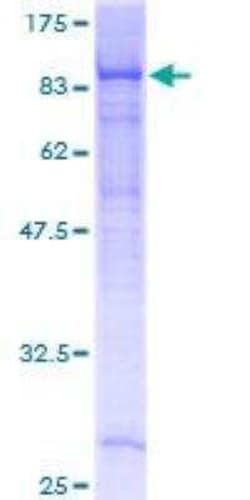 Novus Biologicals Recombinant Human EHD4 GST (N-Term) Protein 25 &mu;g | Buy Online | Novus Biologicals&trade; | Fisher Scientific