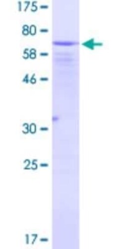 Novus Biologicals Recombinant Human EIF2 beta GST (N-Term) Protein 10 &mu;g | Buy Online | Novus Biologicals&trade; | Fisher Scientific