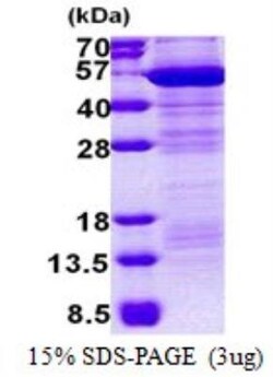 Novus Biologicals&trade;&nbsp;Recombinant Human EMP/MAEA His Protein