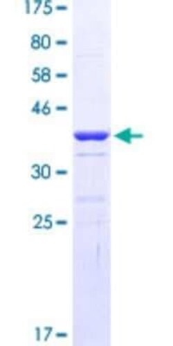 Novus Biologicals Recombinant Human EOMES GST (N-Term) Protein 25 &mu;g | Buy Online | Novus Biologicals&trade; | Fisher Scientific
