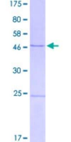 Novus Biologicals&trade;&nbsp;Recombinant Human ERCC8 GST (N-Term) Protein