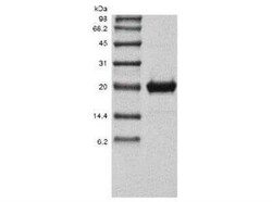 Novus Biologicals Recombinant Human Endostatin Protein 100 &mu;g | Buy Online | Novus Biologicals&trade; | Fisher Scientific