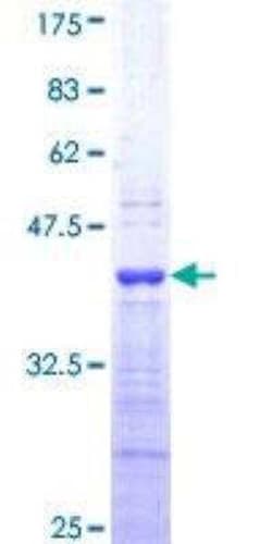 Novus Biologicals Recombinant Human Endothelin-1 GST (N-Term) Protein 25 &mu;g | Buy Online | Novus Biologicals&trade; | Fisher Scientific