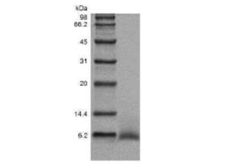 Novus Biologicals Recombinant Human Epiregulin Protein 100 &mu;g | Buy Online | Novus Biologicals&trade; | Fisher Scientific