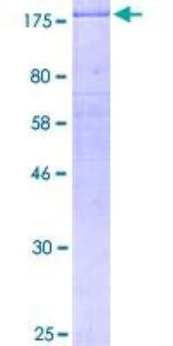 Novus Biologicals™ Recombinant Human ErbB2/Her2 GST (N-Term) Protein