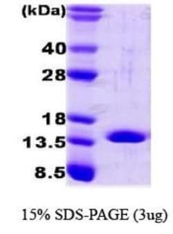 Novus Biologicals&trade;&nbsp;Recombinant Human FABP4/A-FABP Protein