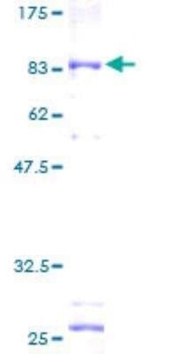 Novus Biologicals Recombinant Human FALDH GST (N-Term) Protein 25 &mu;g | Buy Online | Novus Biologicals&trade; | Fisher Scientific