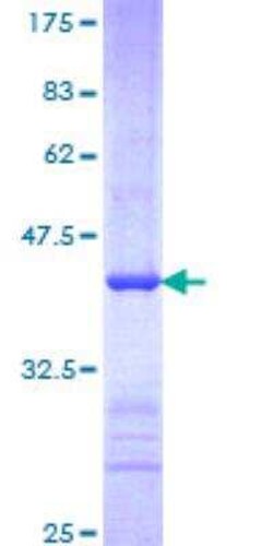 Novus Biologicals&trade;&nbsp;Recombinant Human FBXW7/Cdc4 GST (N-Term) Protein