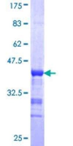 Novus Biologicals Recombinant Human FE65 GST (N-Term) Protein 10 &mu;g | Buy Online | Novus Biologicals&trade; | Fisher Scientific