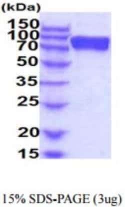 Novus Biologicals Recombinant Human FGFR2 hIgG-His Protein 50 &mu;g | Buy Online | Novus Biologicals&trade; | Fisher Scientific