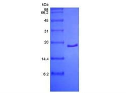 Novus Biologicals Recombinant Human FGF acidic/FGF1 Protein 500 &mu;g | Buy Online | Novus Biologicals&trade; | Fisher Scientific