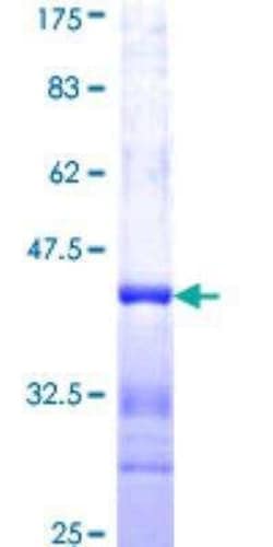 Novus Biologicals Recombinant Human FMNL1 GST (N-Term) Protein 10 &mu;g | Buy Online | Novus Biologicals&trade; | Fisher Scientific