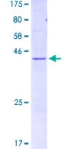 Novus Biologicals Recombinant Human FUNDC2 GST (N-Term) Protein 25 &mu;g | Buy Online | Novus Biologicals&trade; | Fisher Scientific
