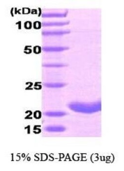 Novus Biologicals&trade;&nbsp;Recombinant Human Ferritin Heavy Chain Protein
