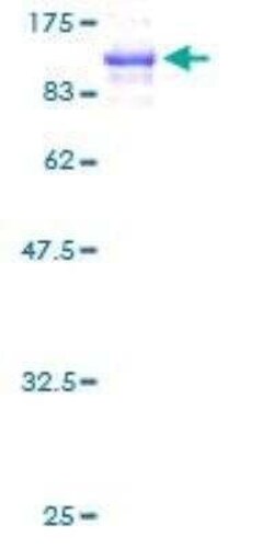 Novus Biologicals Recombinant Human Filamin A GST (N-Term) Protein 10 &mu;g | Buy Online | Novus Biologicals&trade; | Fisher Scientific