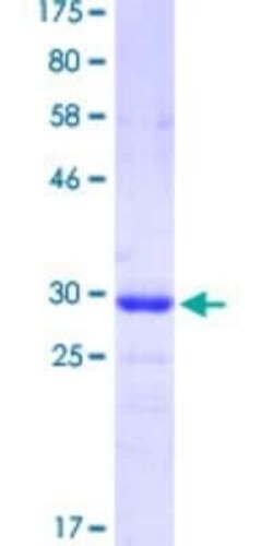 Novus Biologicals Recombinant Human FoxC2 GST (N-Term) Protein 25 &mu;g | Buy Online | Novus Biologicals&trade; | Fisher Scientific