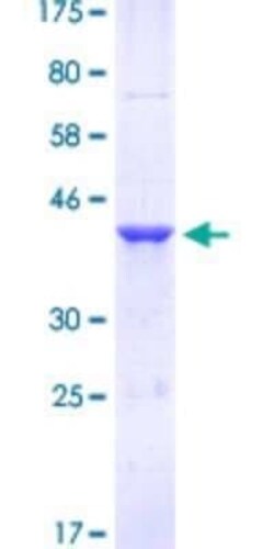 Novus Biologicals Recombinant Human FoxM1 GST (N-Term) Protein 10 &mu;g | Buy Online | Novus Biologicals&trade; | Fisher Scientific