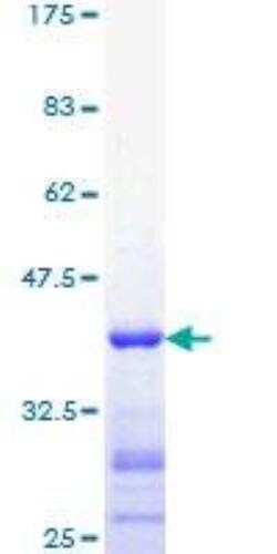 Novus Biologicals Recombinant Human FoxO1/FKHR GST (N-Term) Protein 25 &mu;g | Buy Online | Novus Biologicals&trade; | Fisher Scientific