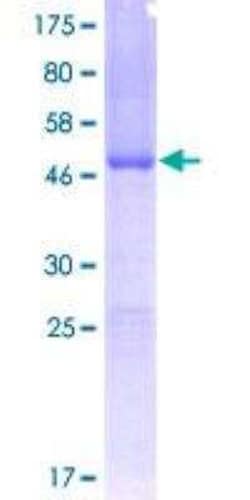 Novus Biologicals Recombinant Human Frataxin GST (N-Term) Protein 25 &mu;g | Buy Online | Novus Biologicals&trade; | Fisher Scientific