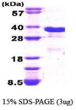 Novus Biologicals Recombinant Human GADD153/CHOP His Protein 0.1 mg | Buy Online | Novus Biologicals&trade; | Fisher Scientific