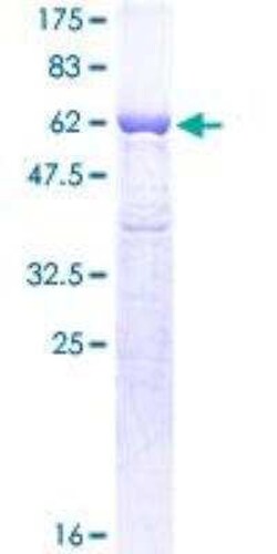 Novus Biologicals Recombinant Human GAPDH GST (N-Term) Protein 10 &mu;g | Buy Online | Novus Biologicals&trade; | Fisher Scientific
